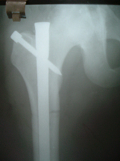 coimbatore-orthopaedic-joint-replacement-maternity-child-welfare-centre-india